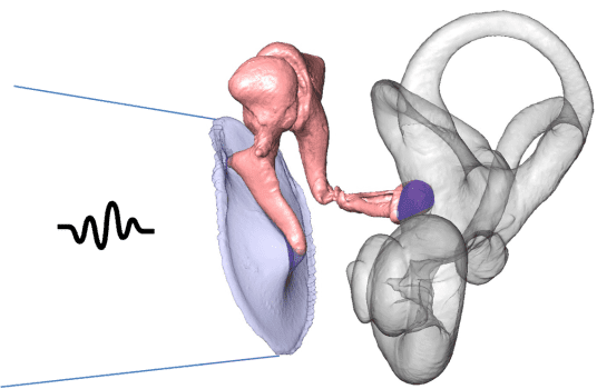 in-situ reconstruction of the ossicular chain